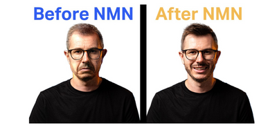 NMN Review: The Best Anti-Aging Supplement In The World?