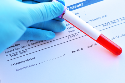 What Does Homocysteine Do? Understanding Its Role in Health and Disease