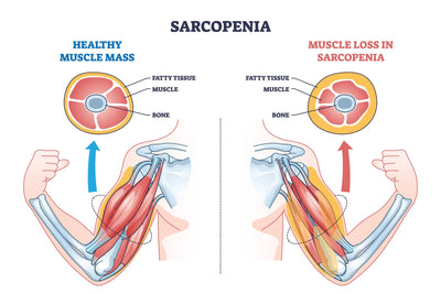 Sarcopenia: The Muscle-Loss Clock You Can Actually Slow
